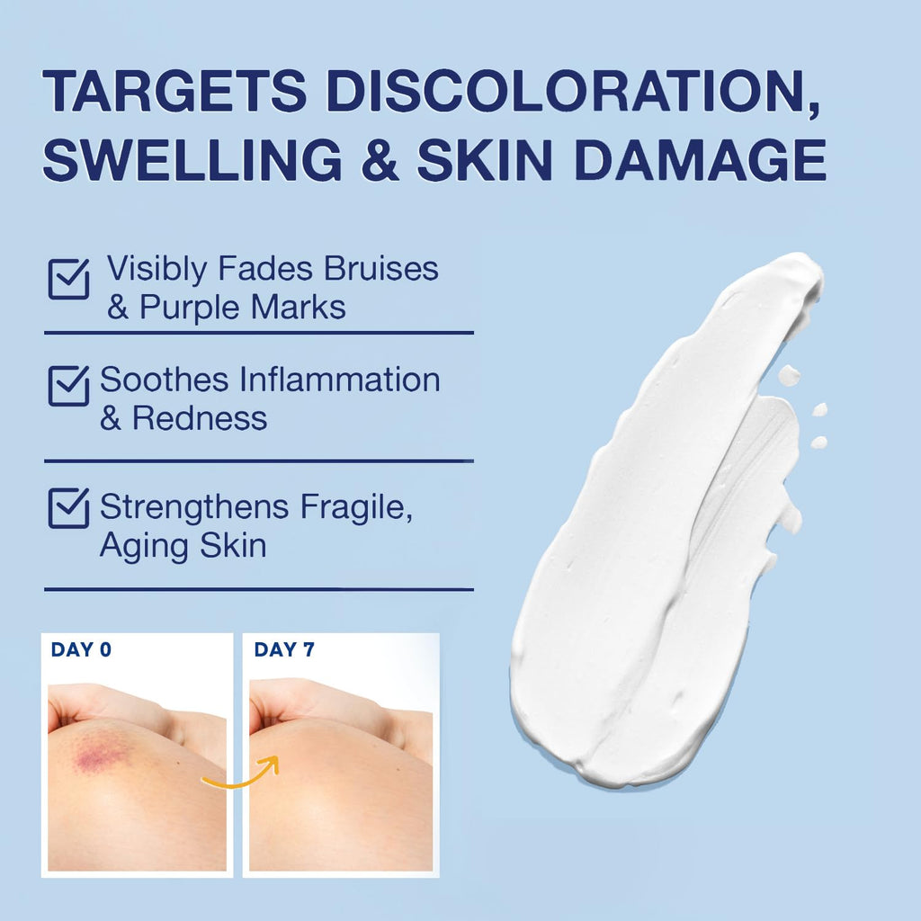PHARMBANNER Arnica Bruise Cream Extra Strength – Fast-Acting with Vitamins K C E