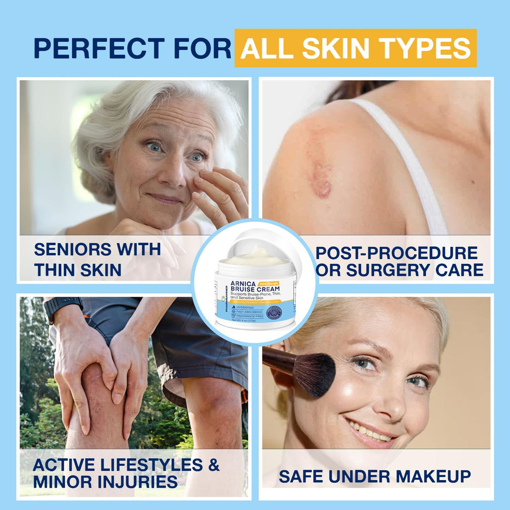 PHARMBANNER Arnica Bruise Cream Extra Strength – Fast-Acting with Vitamins K C E