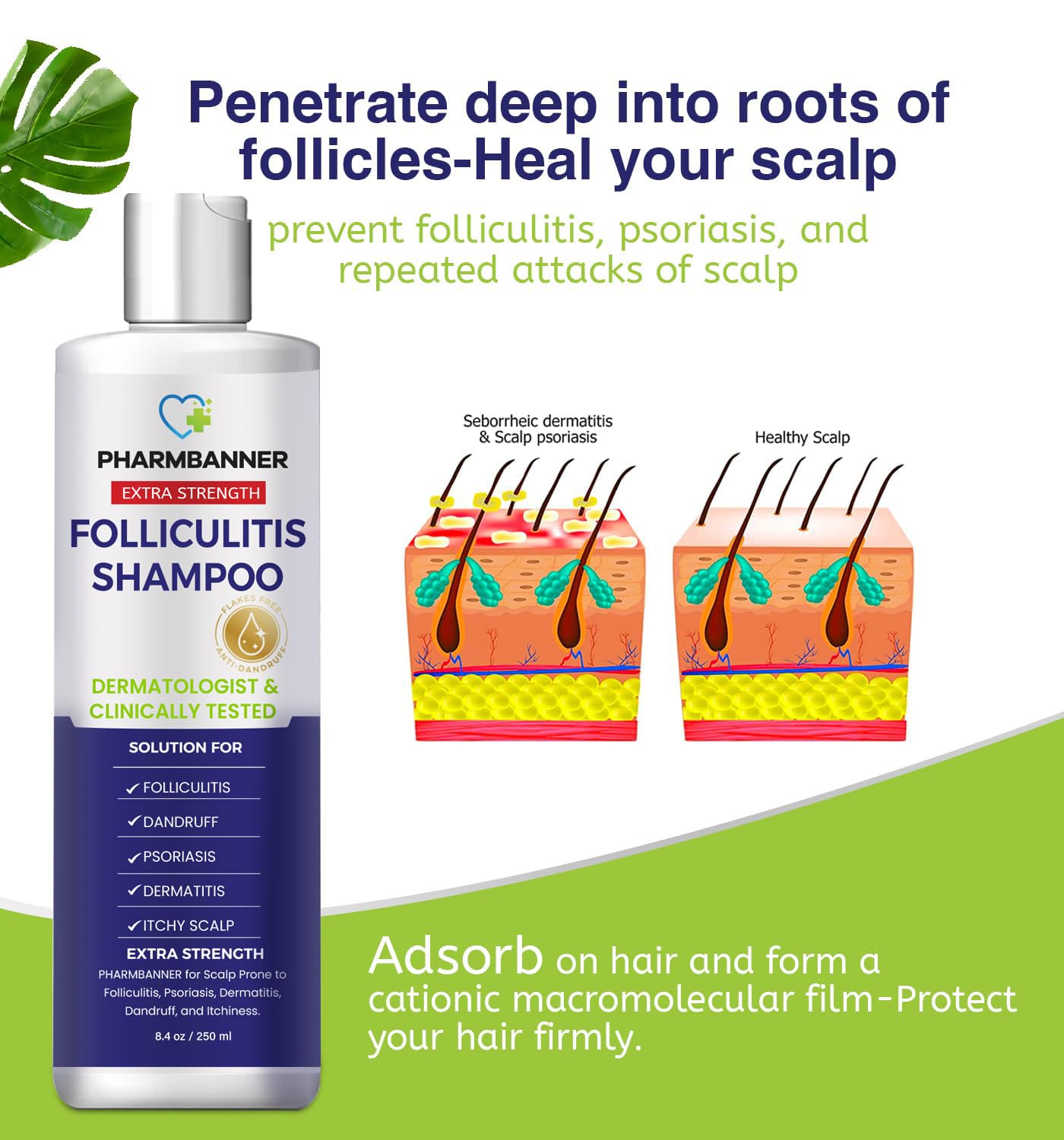 PHARMBANNER Anti-Fungal Shampoo for Folliculitis, Seborrheic Dermatitis & Scalp Psoriasis