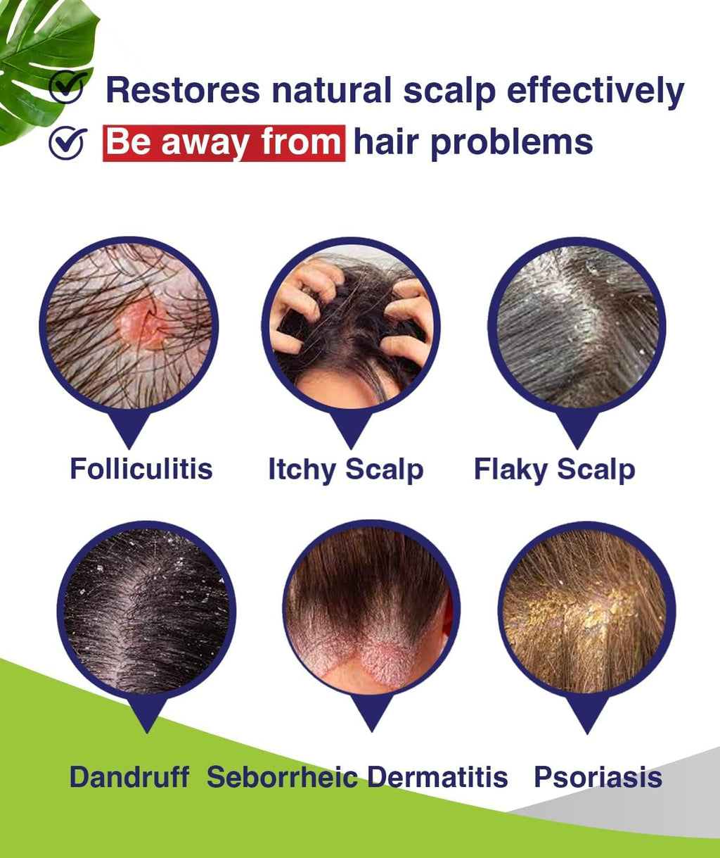 PHARMBANNER Anti-Fungal Shampoo for Folliculitis, Seborrheic Dermatitis & Scalp Psoriasis