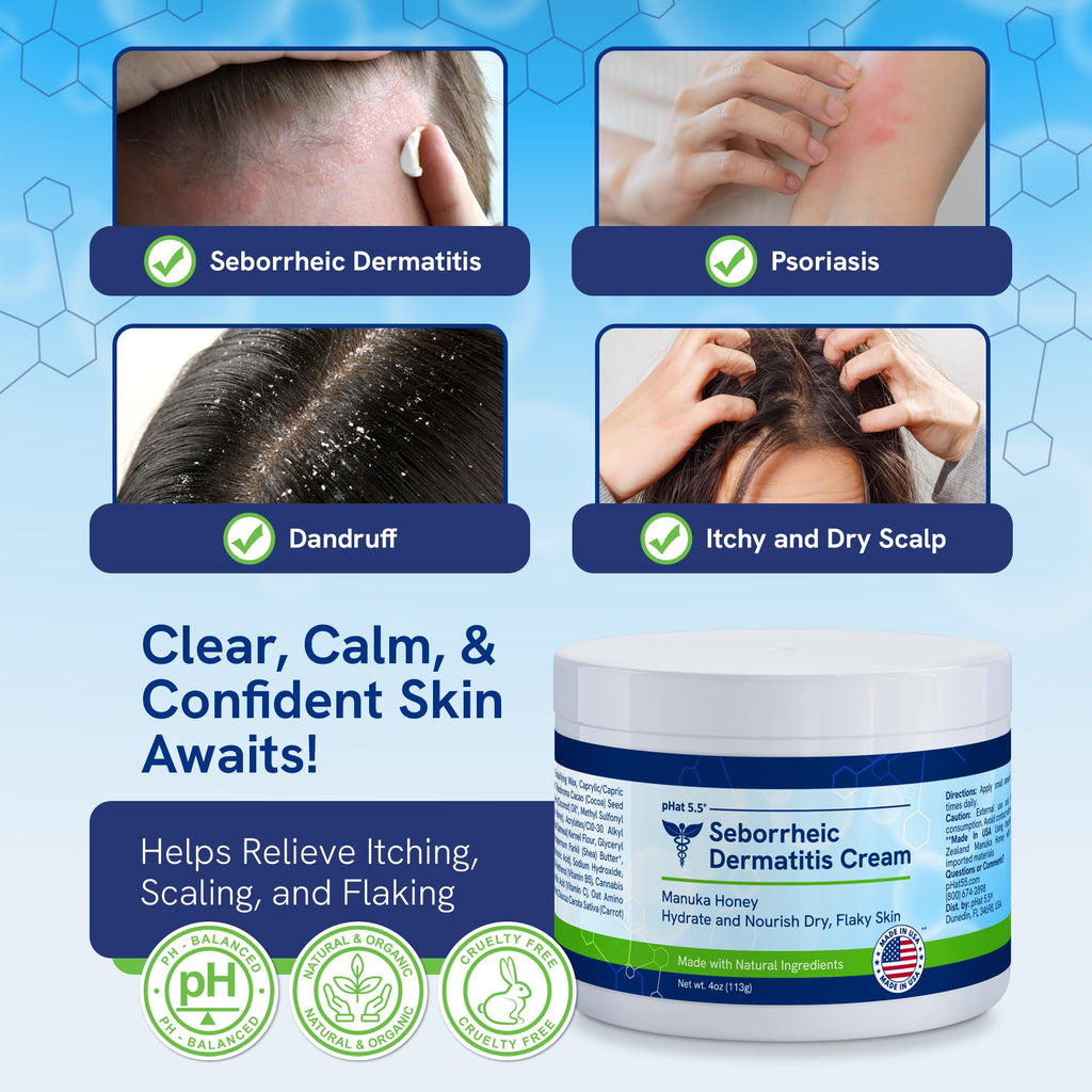 pHat 5.5 Itch Cream – Anti-Itch Relief & Hydration (4oz)