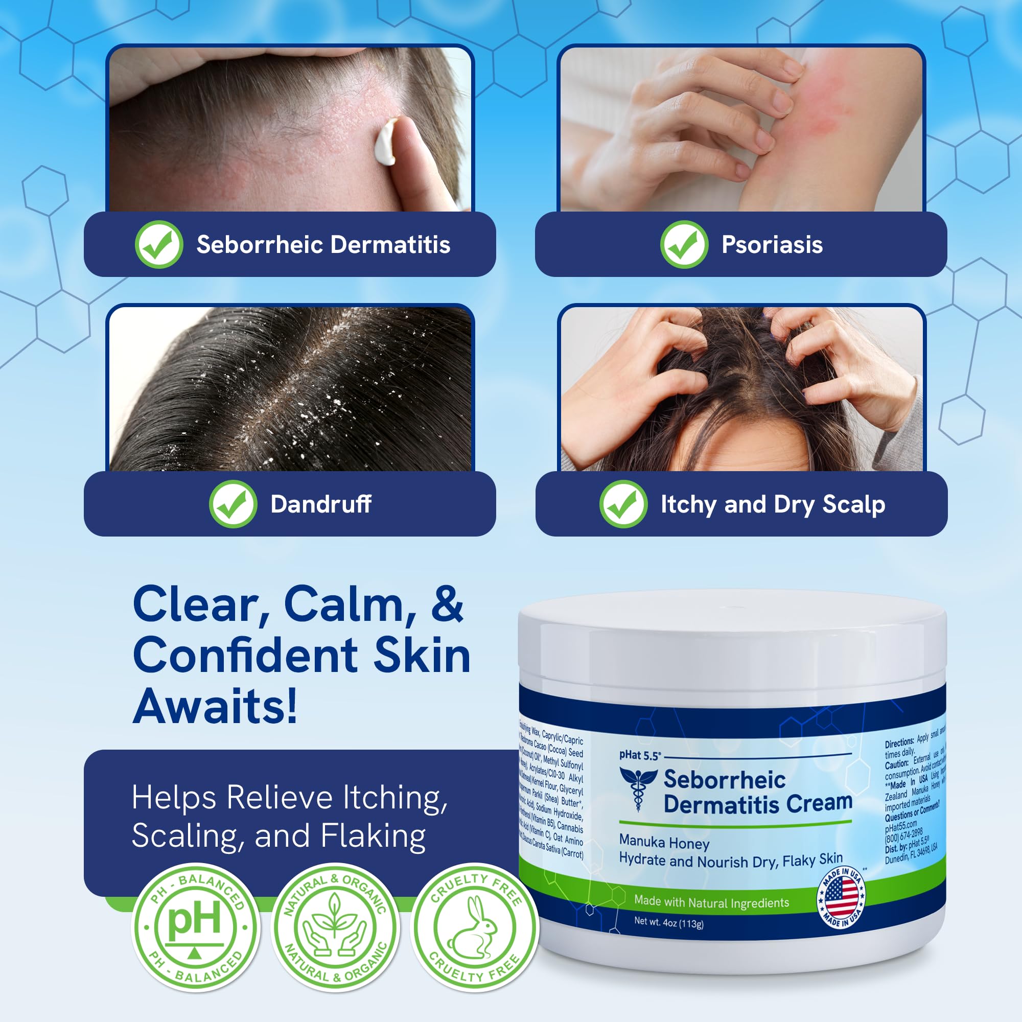 pHat 5.5 Itch Cream – Anti-Itch Relief & Hydration (4oz)