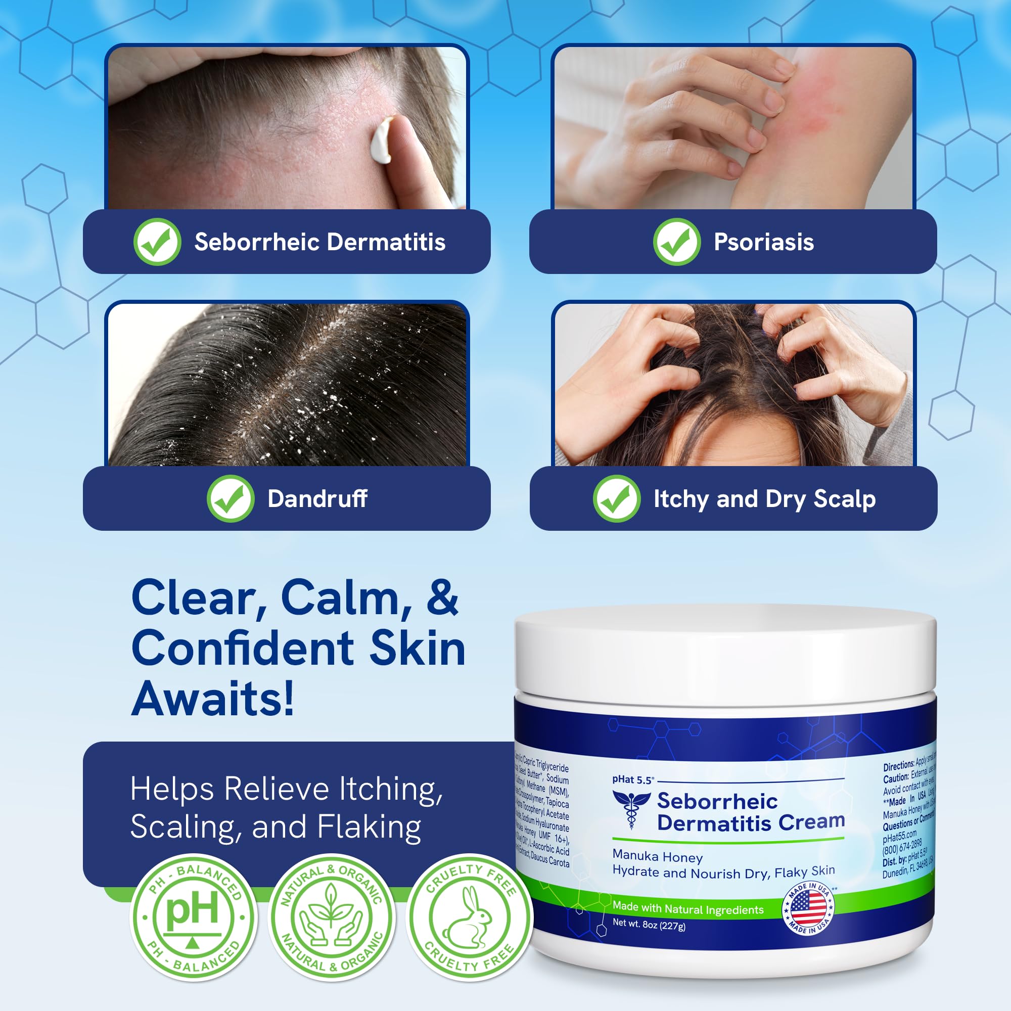 pHat 5.5 Seborrheic Dermatitis Moisturizing Cream & Face Lotion for Women – Hydrating Anti-Itch (8oz)