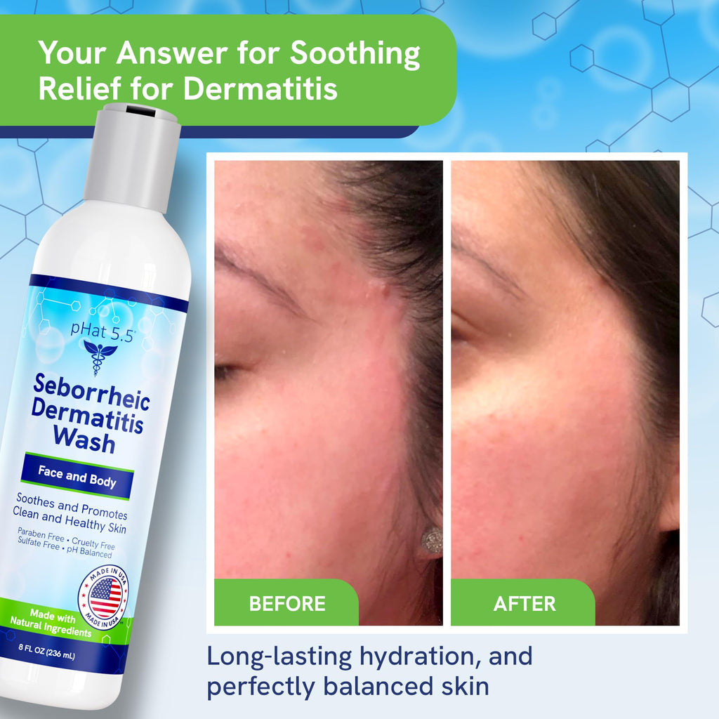 pHat 5.5 Seborrheic & Atopic Dermatitis Gentle Face Wash with Manuka Honey | Sensitive Skin Cleanser