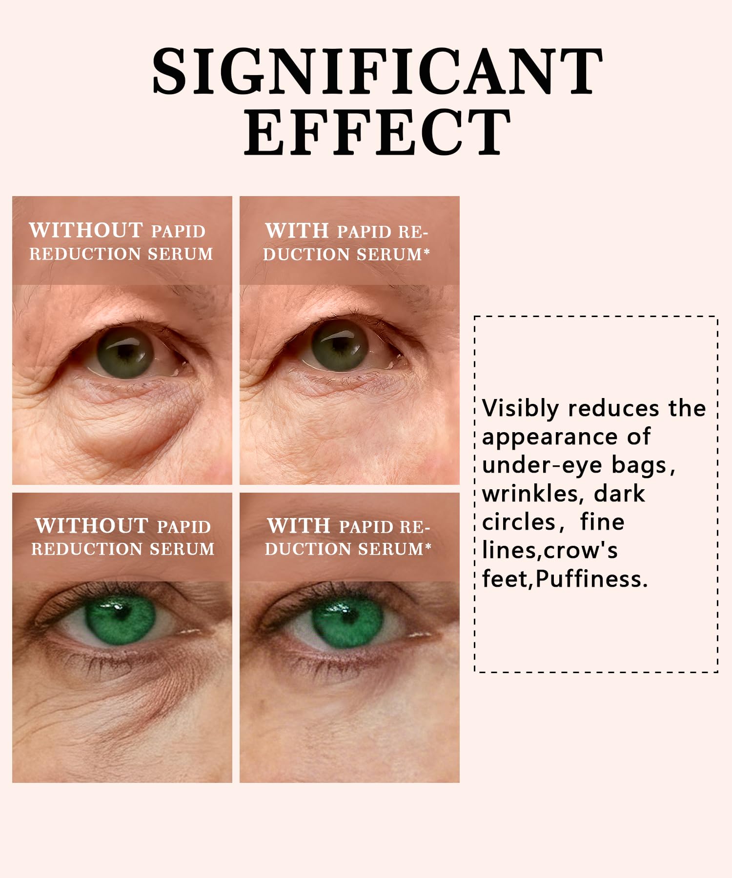 Phydrulis 2 PCS Temporary Eye Tightener – Perfection Firming Lift Cream & Instant Eye Serum (1 oz)