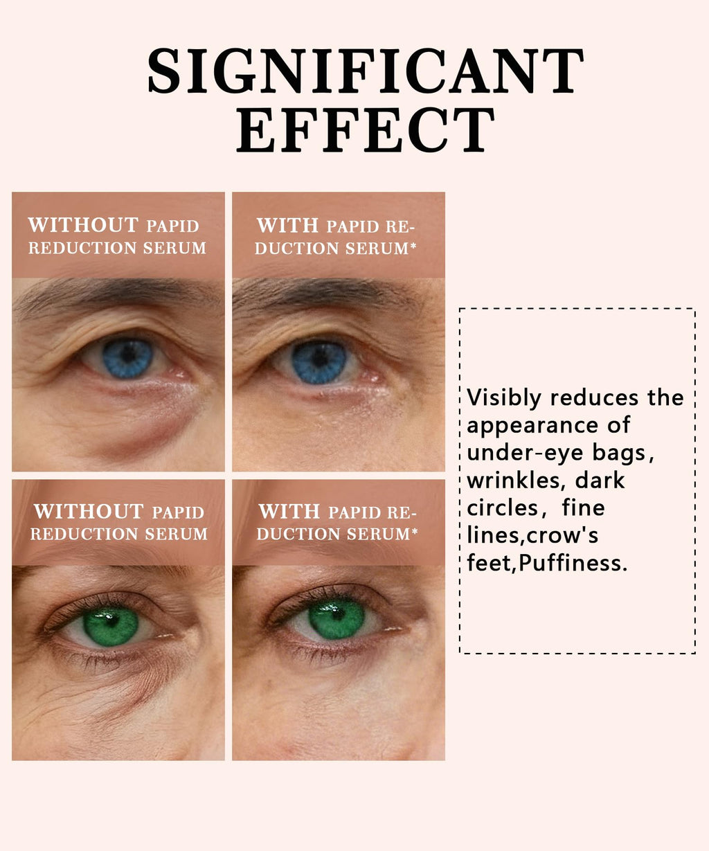 Phydrulis 2 PCS Temporary Eye Tightener – Perfection Firming Lift Cream & Instant Eye Serum (1 oz)