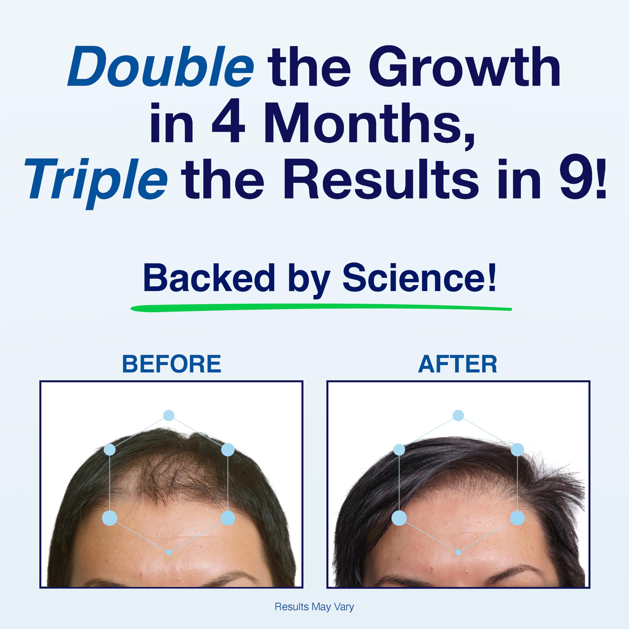 Phyllotex Hair Growth Vitamins for Women & Men – Patented, Doctor-Recommended