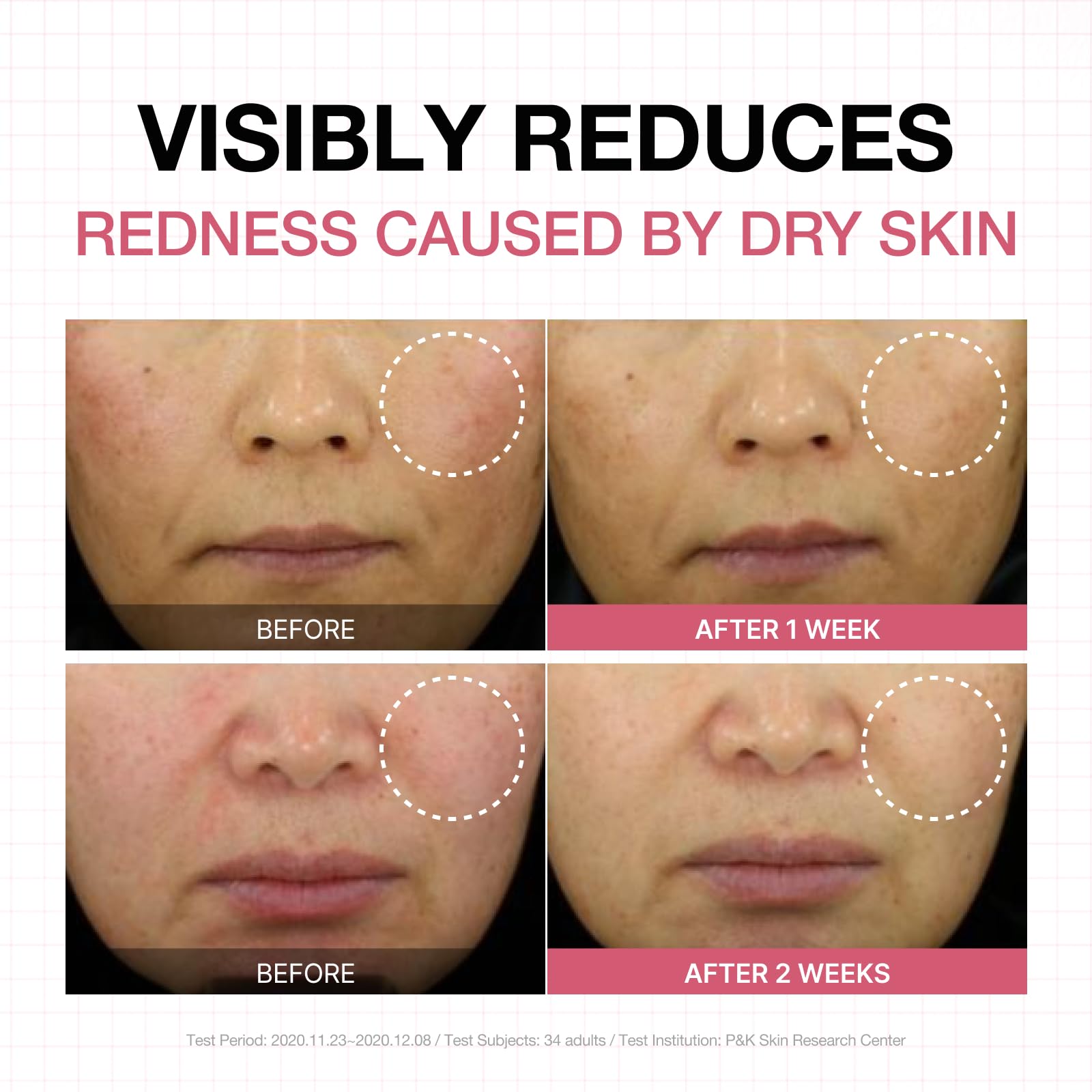 Physiogel Calming Relief Face & Body Lotion – Reduces Redness in 3 Days, Fragrance-Free, Dermatologist-Tested