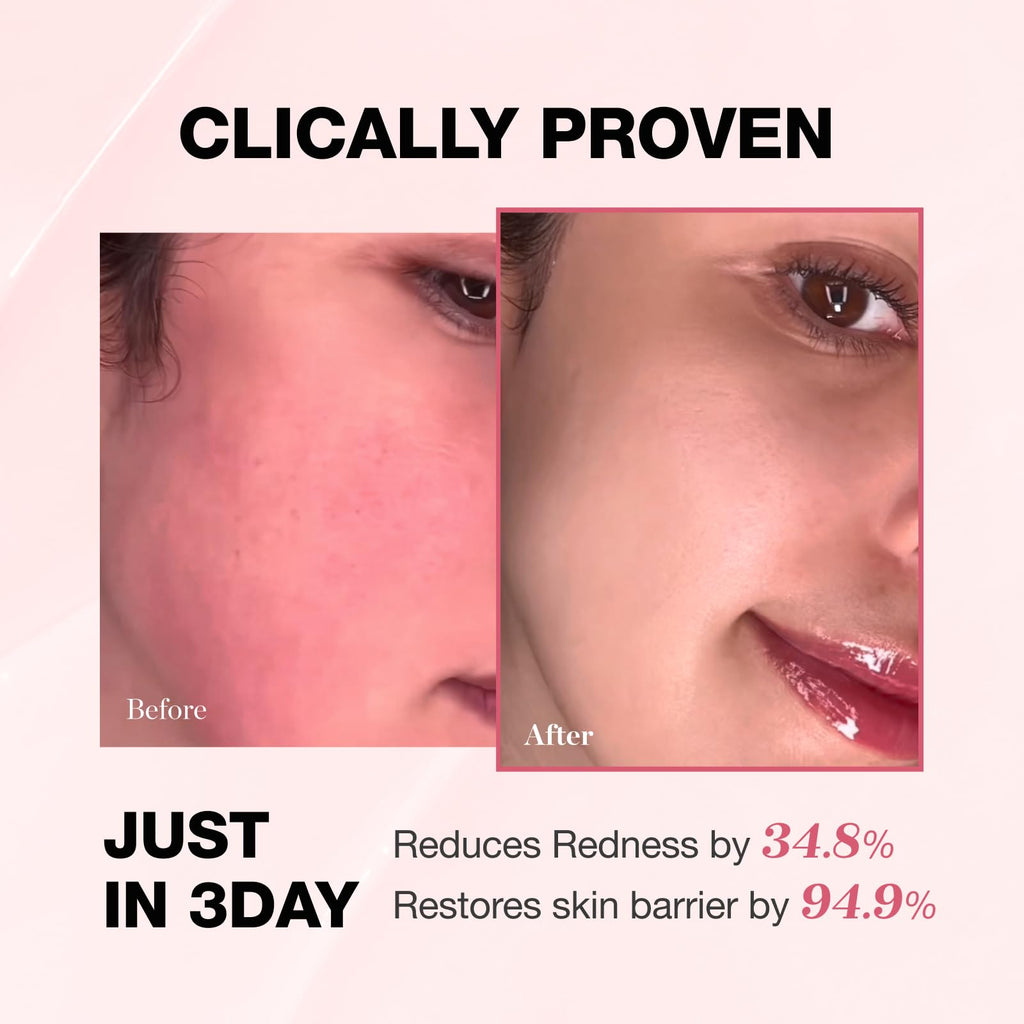 Physiogel Redness Reducing Cream – Ceramide Moisturizer for Sensitive Skin