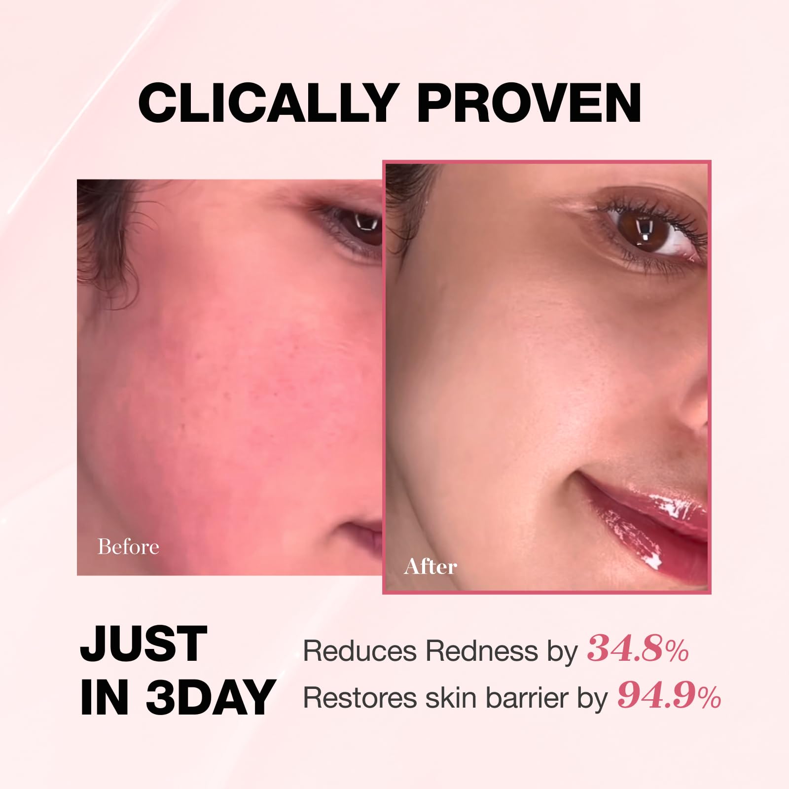 Physiogel Redness Reducing Cream – Ceramide Moisturizer for Sensitive Skin