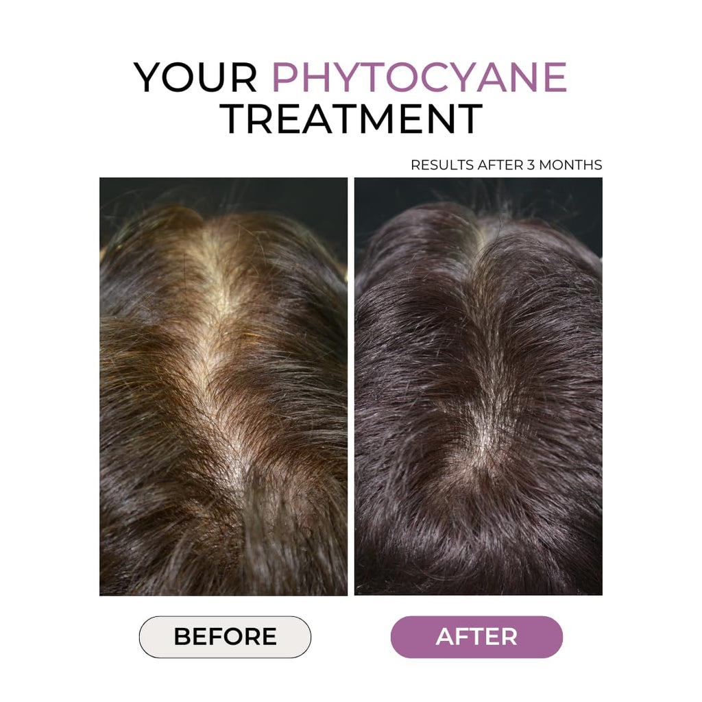 PHYTOCYANE Anti-Hair Thinning Dietary Supplement — 84 Capsules, 12-Week Supply, Vegan & Gluten/Lactose-Free