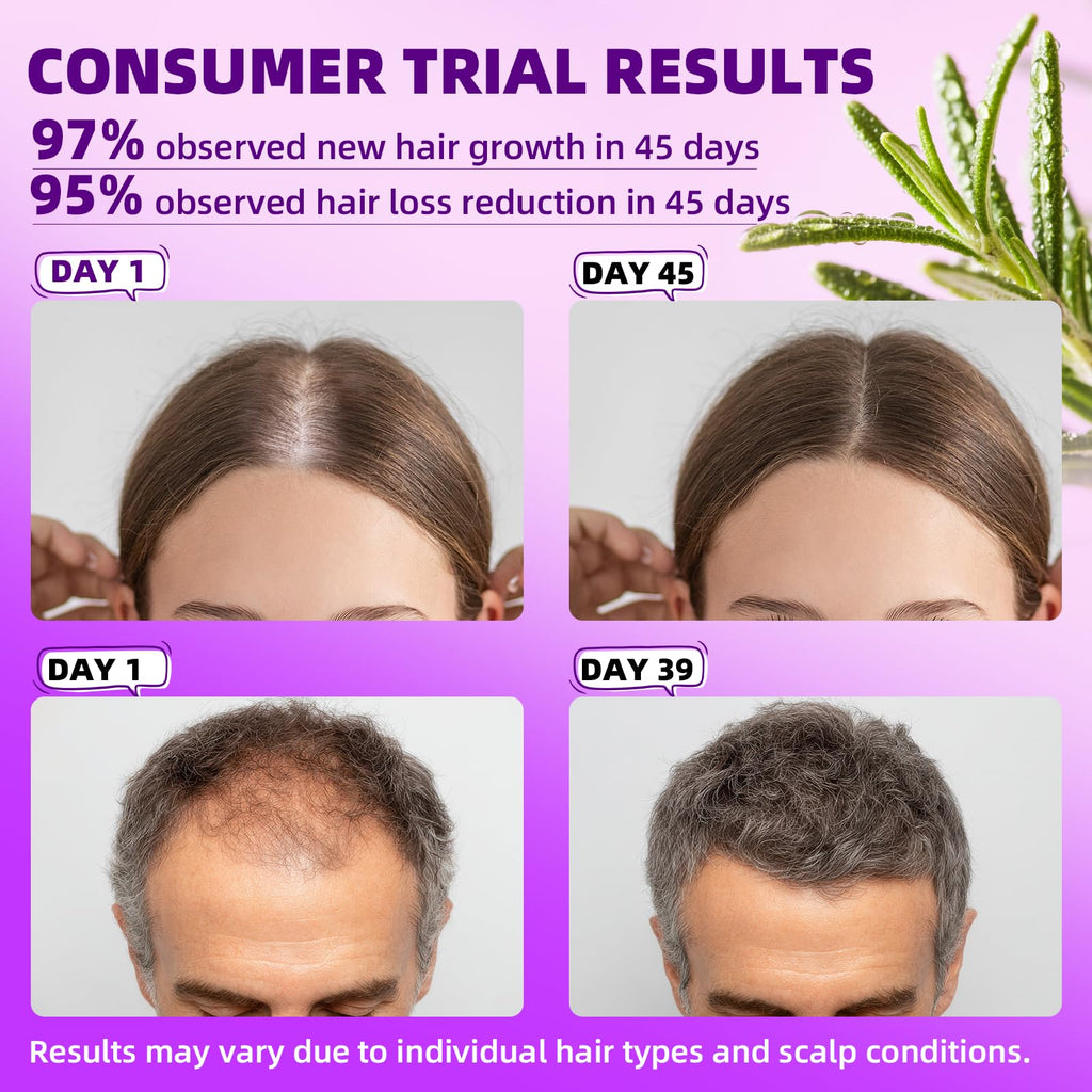 Pipuxi 5% Minoxidil Hair Growth Spray for Men & Women – Biotin + Rosemary