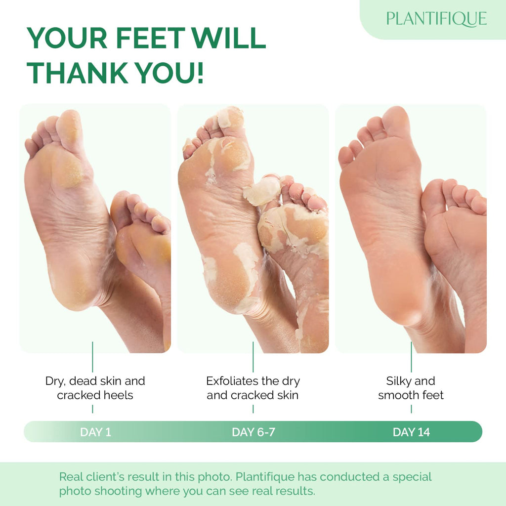 PLANTIFIQUE Foot Peeling Mask 4 Pack | Dermatologically Tested for Baby Soft Feet | Peach