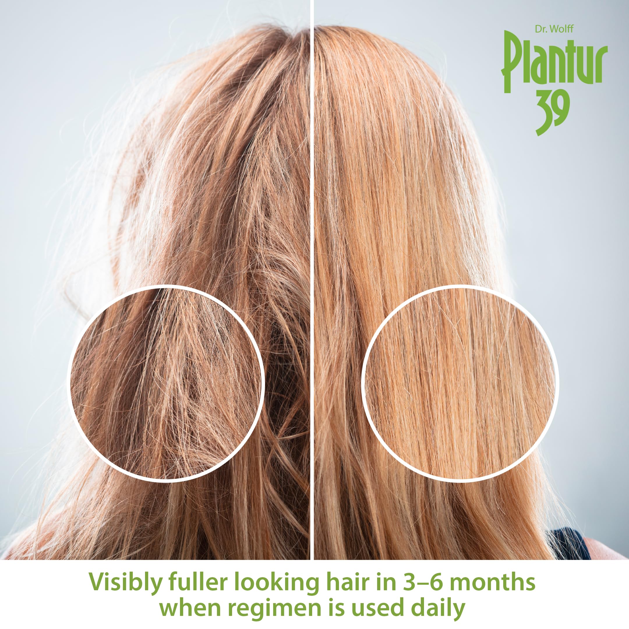 Plantur 39 Fine & Brittle Hair Shampoo – Phyto-Caffeine Formula for Women’s Thinning Hair | 16.9 fl oz
