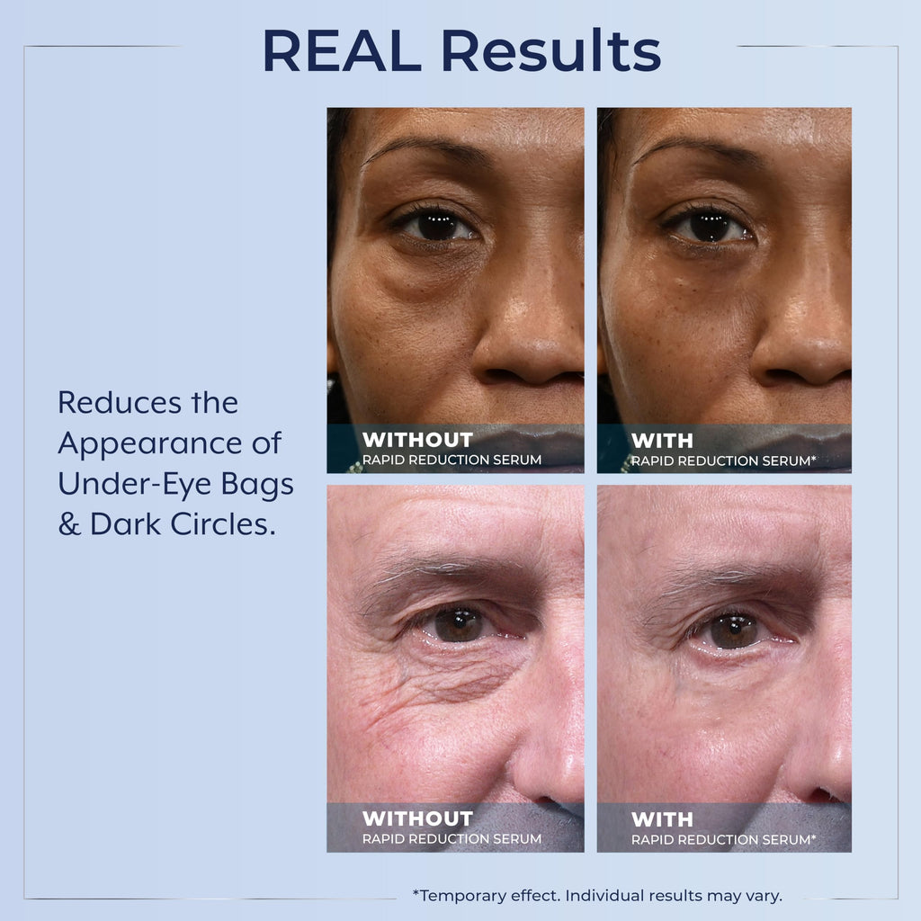 Plexaderm Rapid Reduction Eye Serum – Instant Under-Eye Smoothing & Fine Line Relief