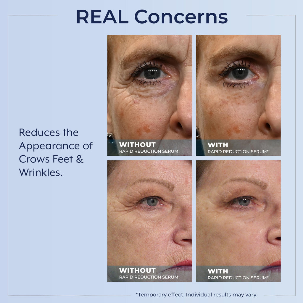 Plexaderm Rapid Reduction Eye Serum – Instant Under-Eye Lift, Reducing Bags & Wrinkles