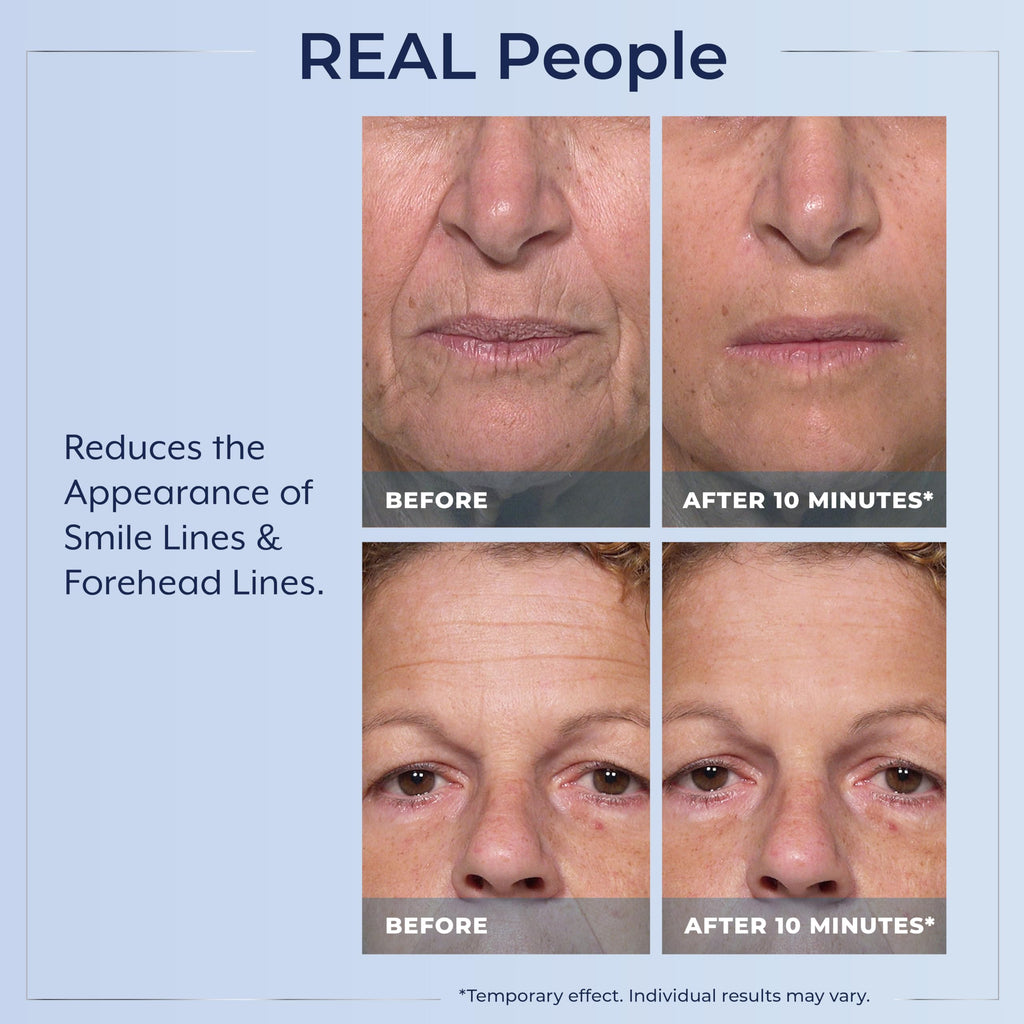Plexaderm Rapid Reduction Eye Serum – Instant Under-Eye Smoothing & Fine Line Relief