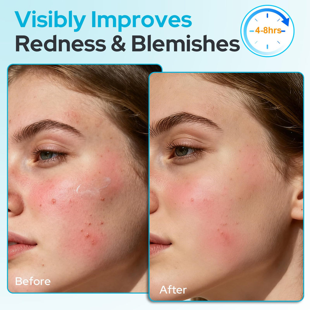 +1HEROLABS 2% Salicylic Acid Gel Serum — 45% Centella Asiatica, Pore Clarifying & Oil Balancing (Fragrance-Free)