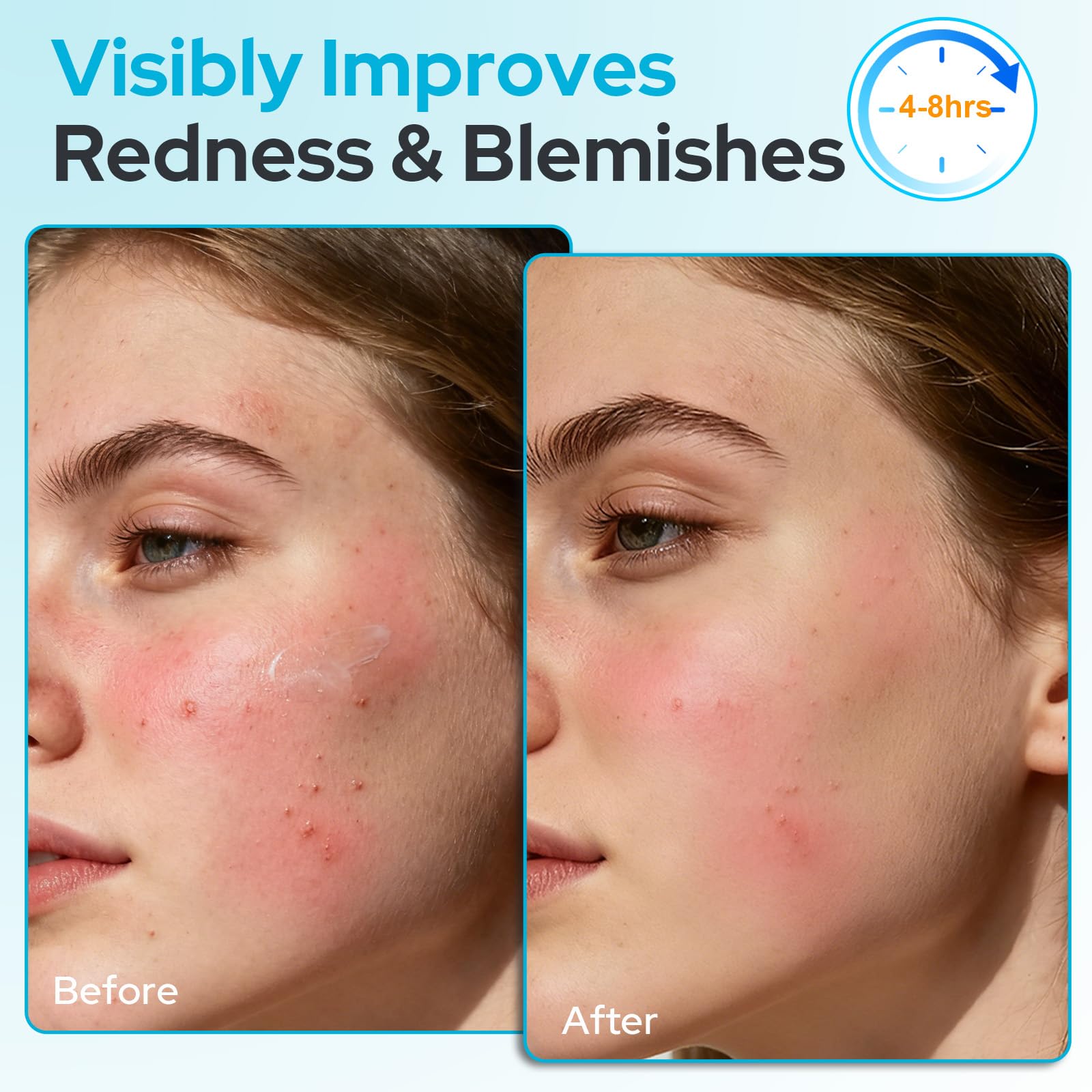 +1HEROLABS 2% Salicylic Acid Gel Serum — 45% Centella Asiatica, Pore Clarifying & Oil Balancing (Fragrance-Free)