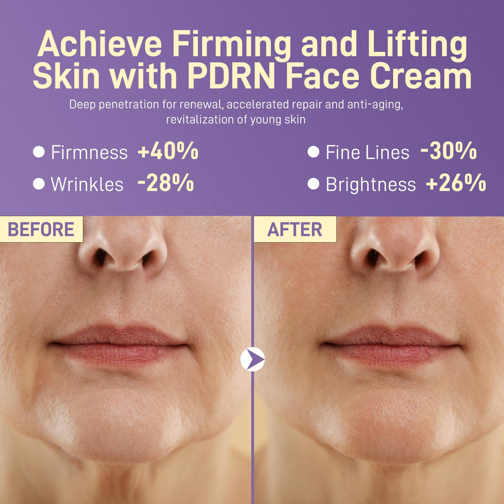 +1HEROLABS PDRN Anti-Aging Face Moisturizer Cream – 5% Squalane, 100% Pure Salmon PDRN, Hyaluronic Acid & B5