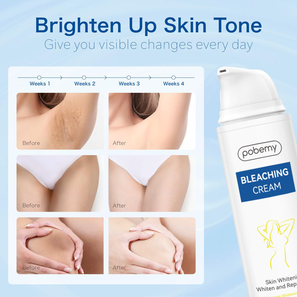 POBEMY Skin Bleaching Cream – Vitamin C Brightening for Face & Body (1.7 fl oz)