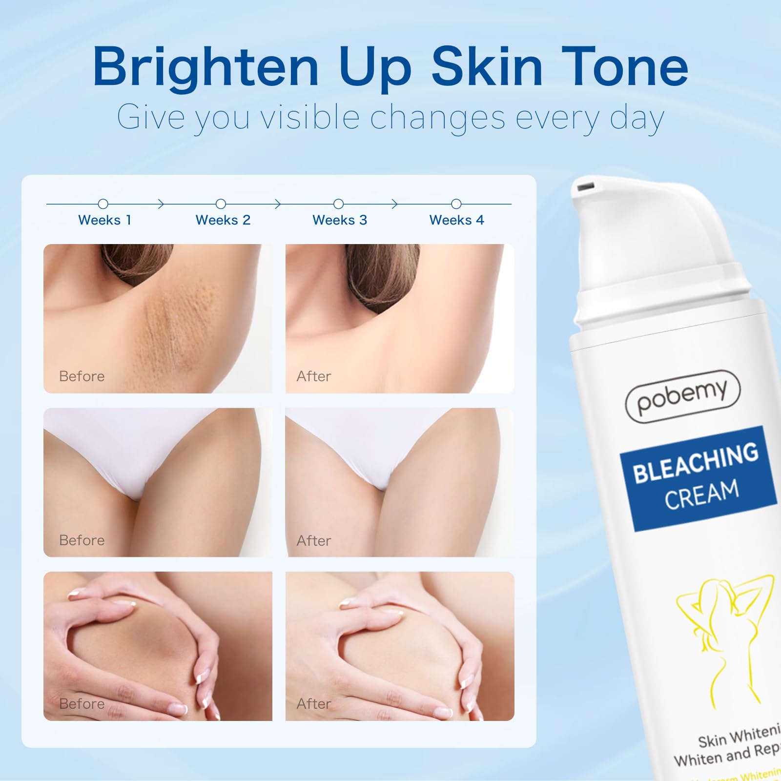 POBEMY Skin Bleaching Cream – Vitamin C Brightening for Face & Body (1.7 fl oz)