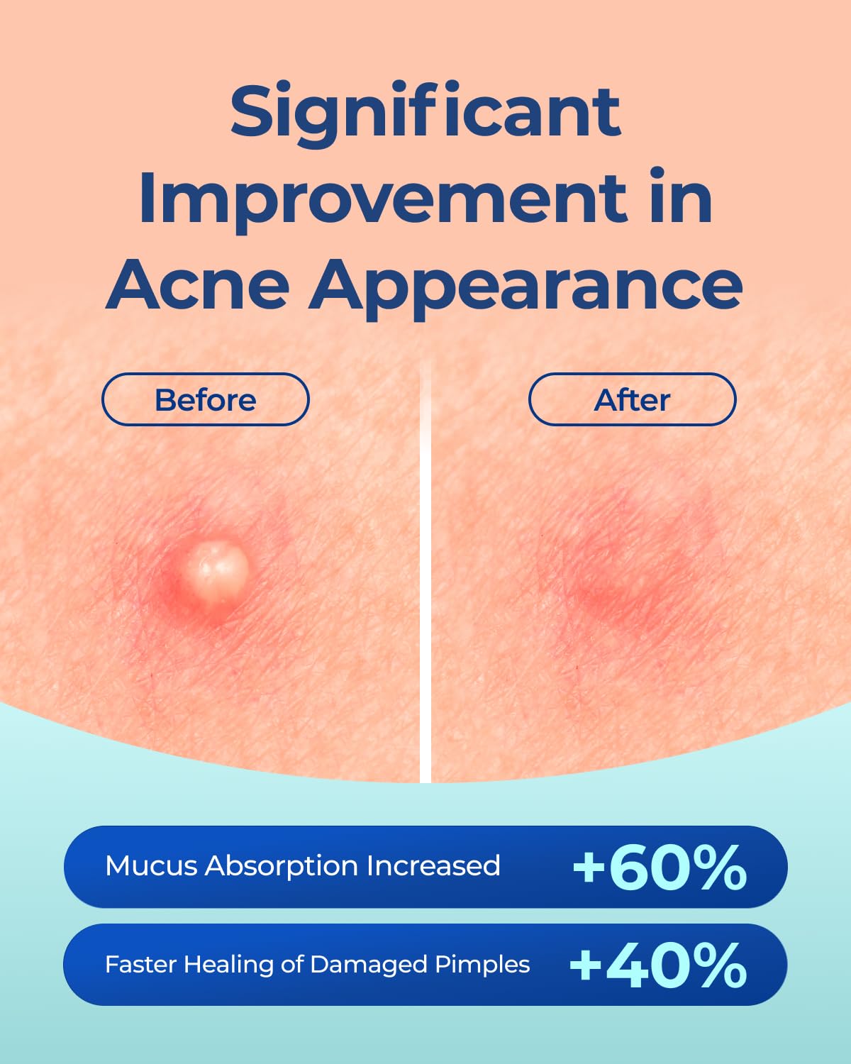 POINTMASS Pimple Patches – Invisible 0.1mm Hydrocolloid with Tea Tree Oil | 132 Dots, 2 Sizes