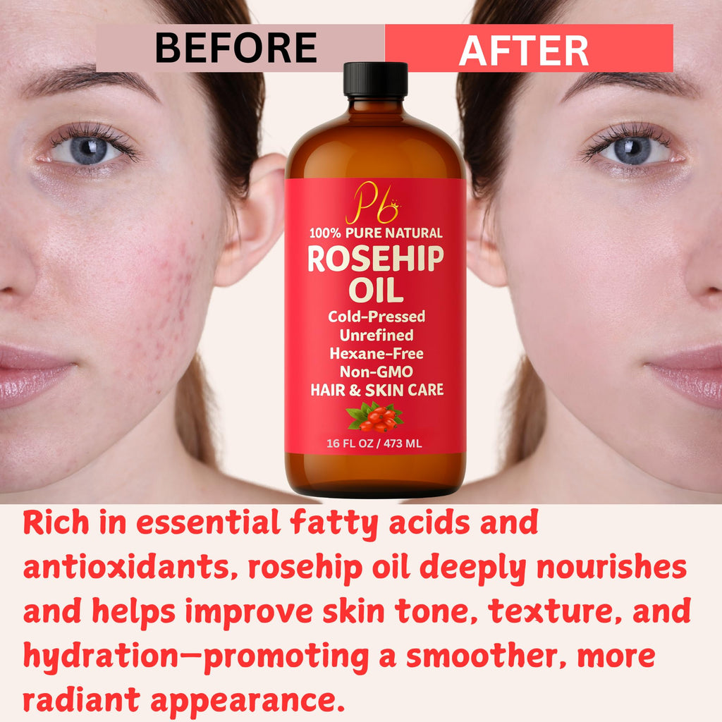 Pomberries Rosehip Seed Oil | Cold-Pressed & Unrefined, 16 oz Bottle for Face, Skin & Hair