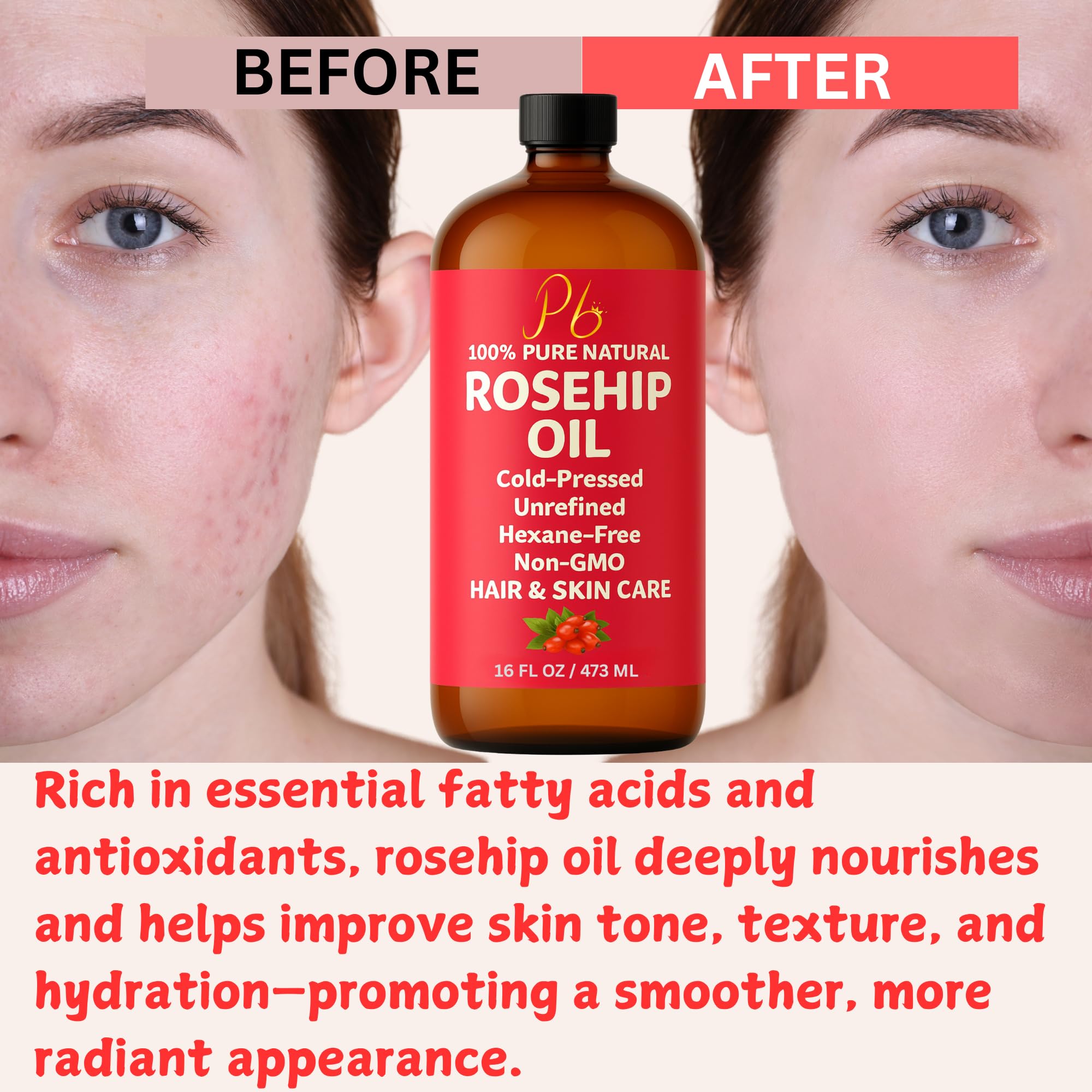Pomberries Rosehip Seed Oil | Cold-Pressed & Unrefined, 16 oz Bottle for Face, Skin & Hair
