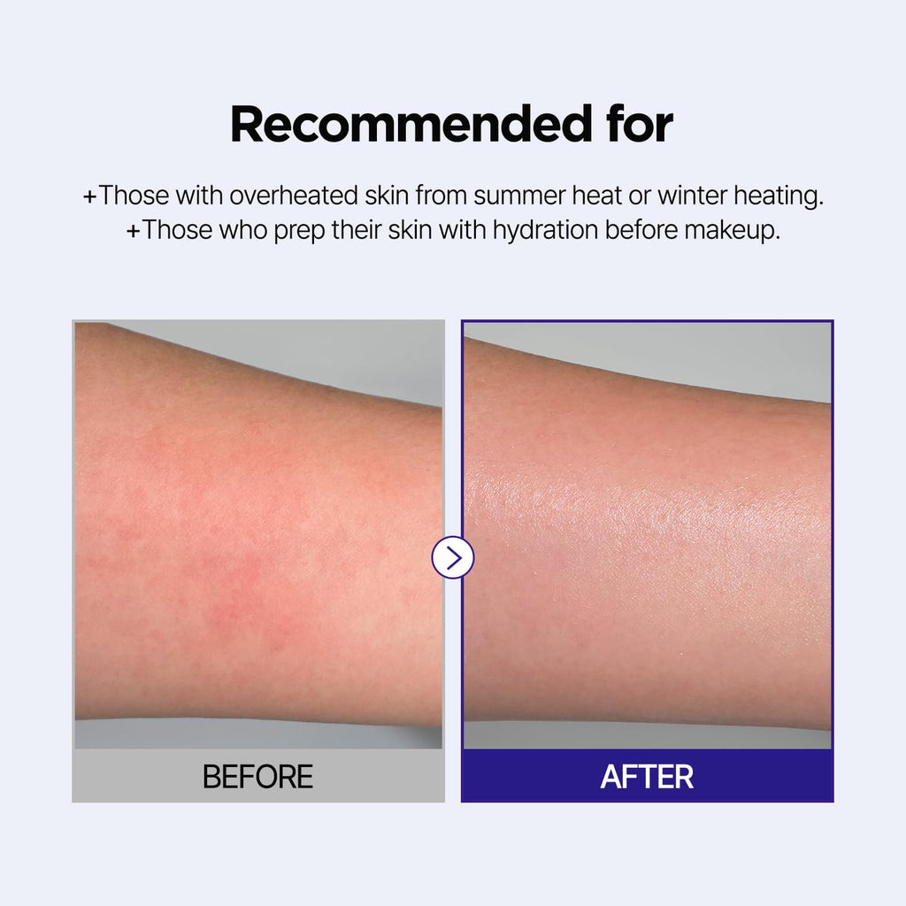PONGDANG Dewy Glow Azulene Gel Toner Pad – Cooling & Calming 3-in-1 Toner