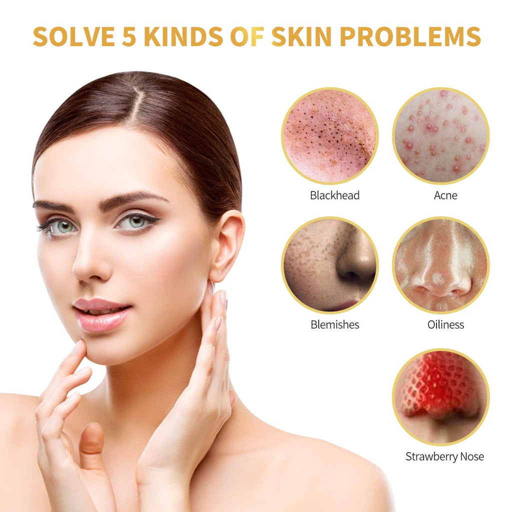 POP MODERN.C Blackhead Remover Mask | 24K Gold Peel Off Facial Mask for Deep Clean & Anti-Aging