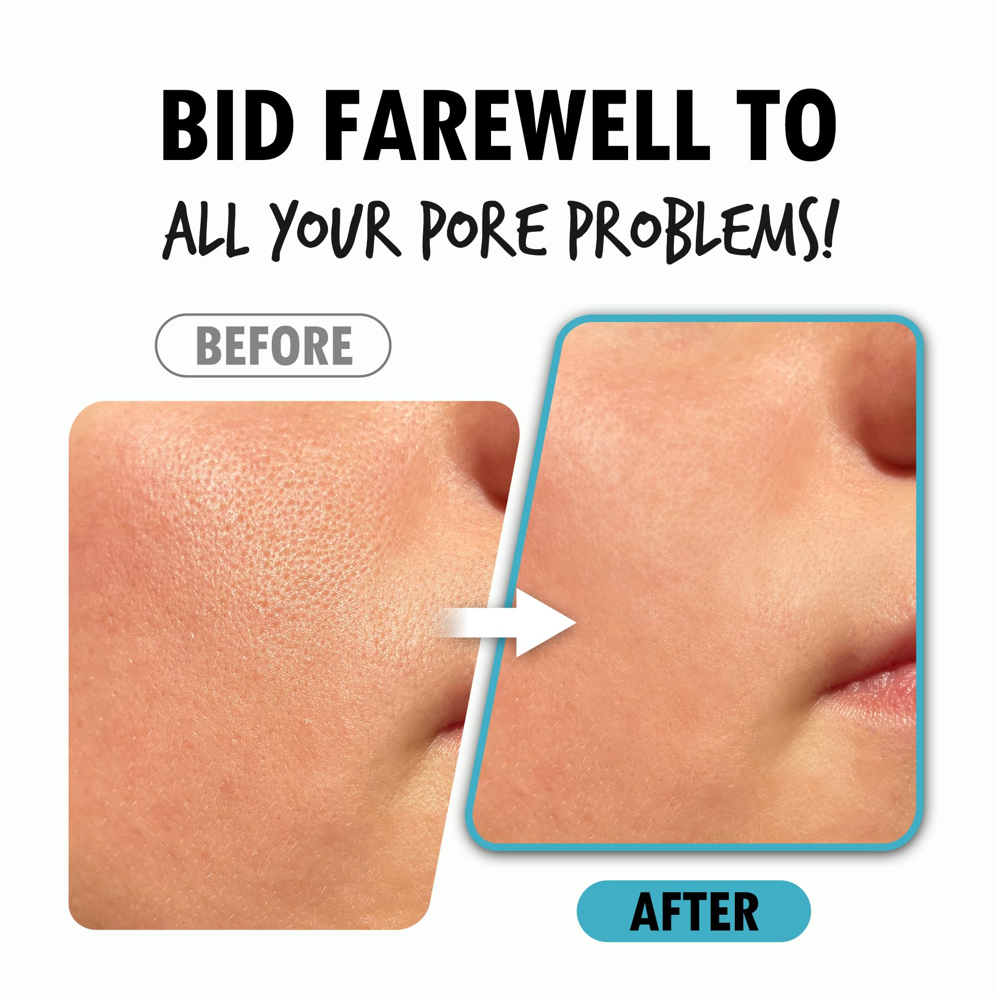 Pour La Peau Pore Refining Serum | Pore Minimizing Hydrating Face Serum (1.01 oz)