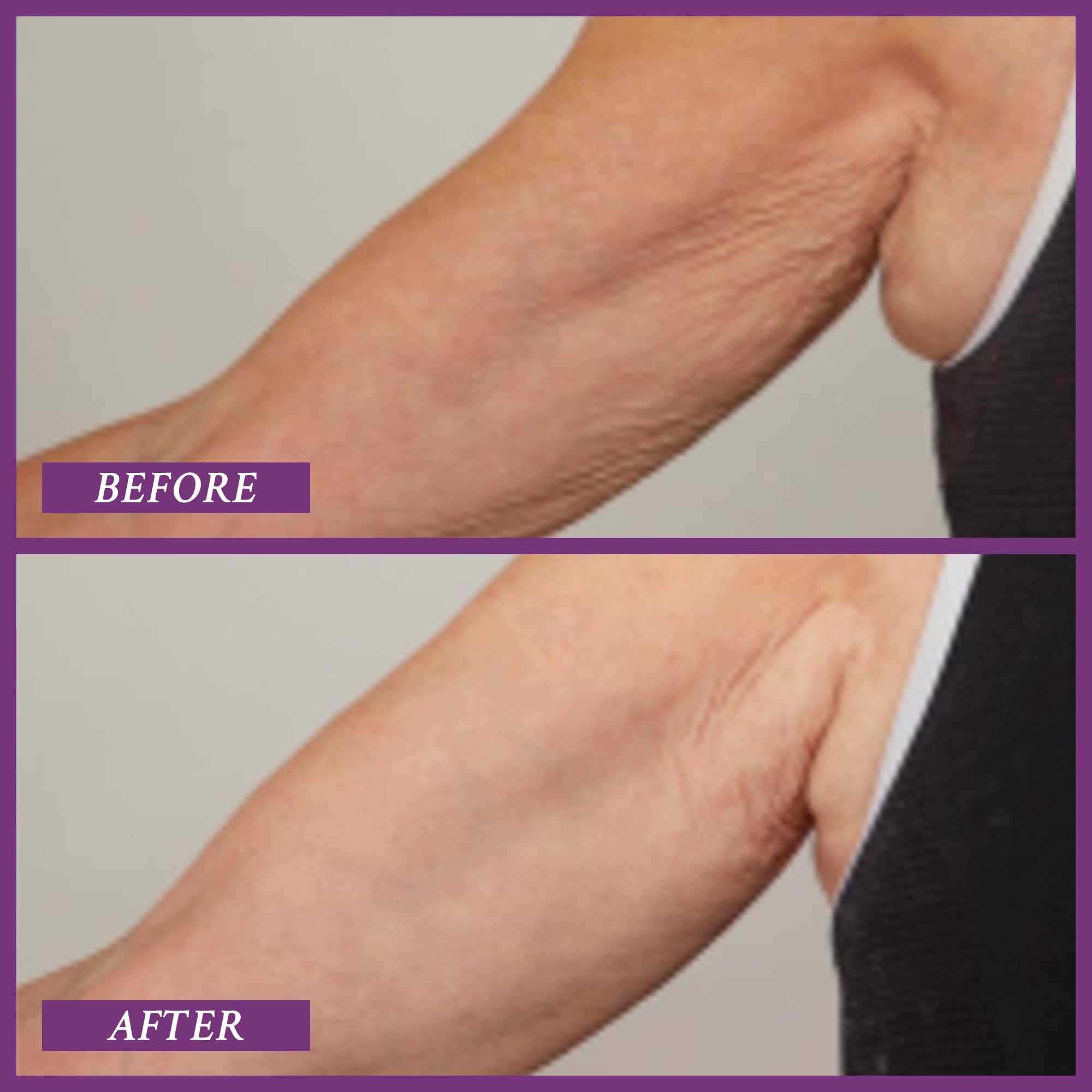 PRAI Beauty Ageless Upper Arm Creme — Firming & Tightening Body Lotion for Upper Arms, 6.7 oz