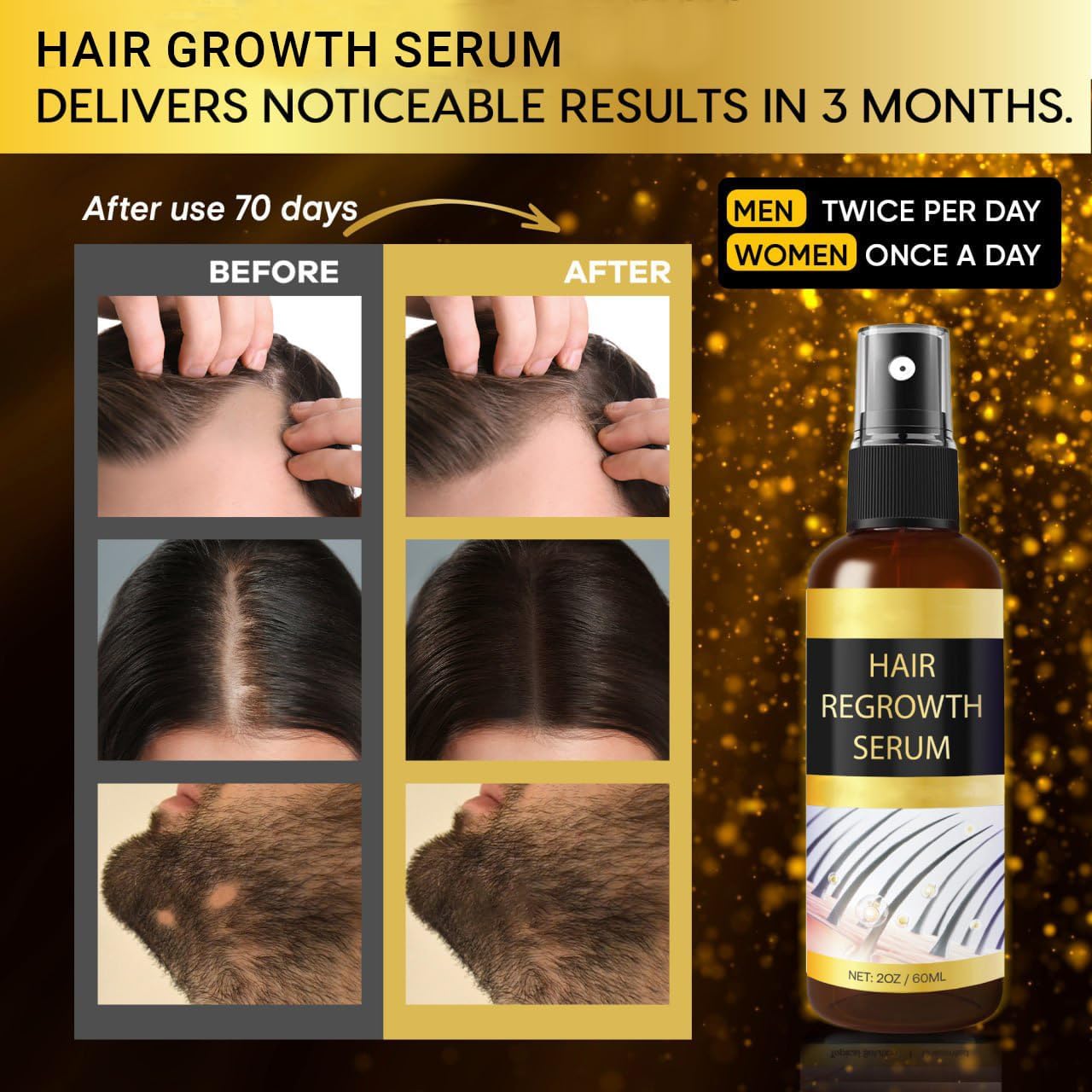 Praiasol Hair Growth Oil Spray – Biotin, Rosemary & Ginseng for Fuller, Thicker Hair