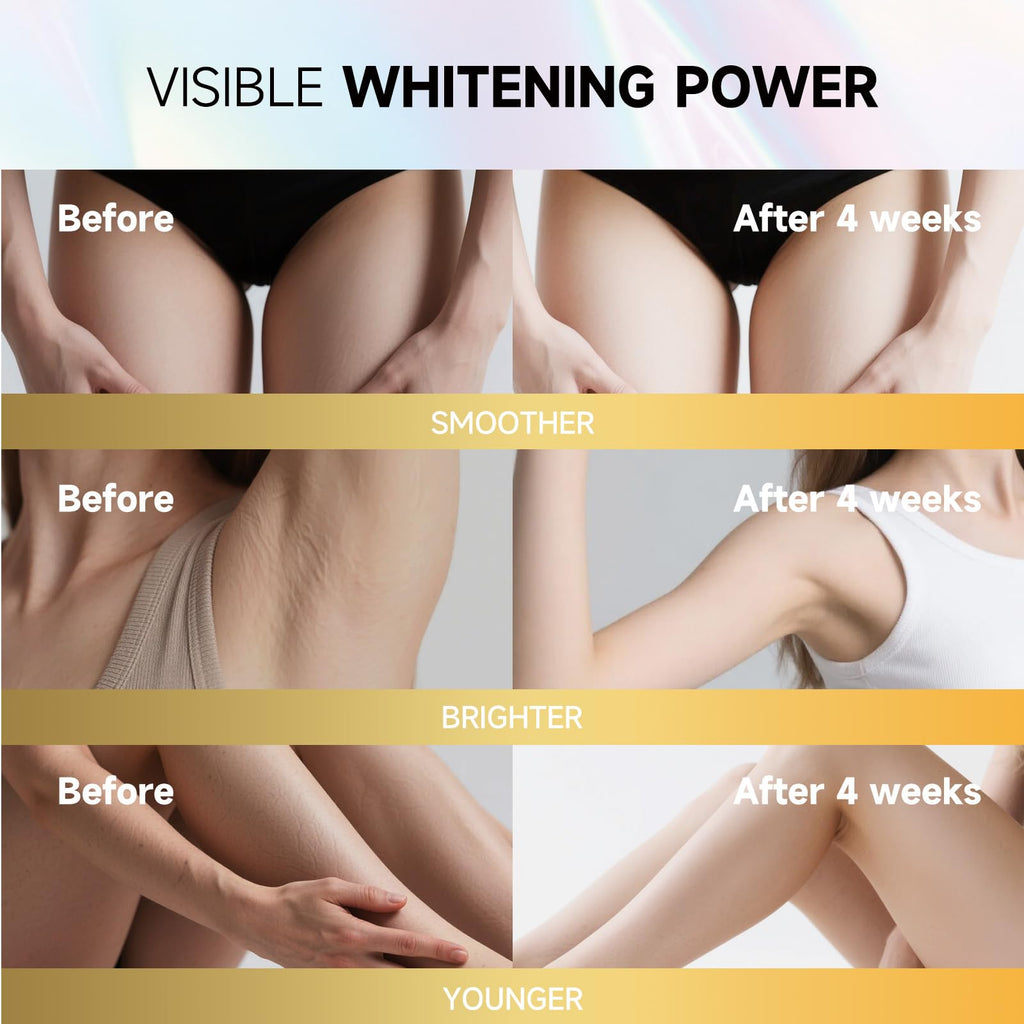PRFTMK Skin Bleaching Cream with Vitamin C – Dark Spot Remover for Underarms, Elbows, Knees & Bikini Line (50ml)