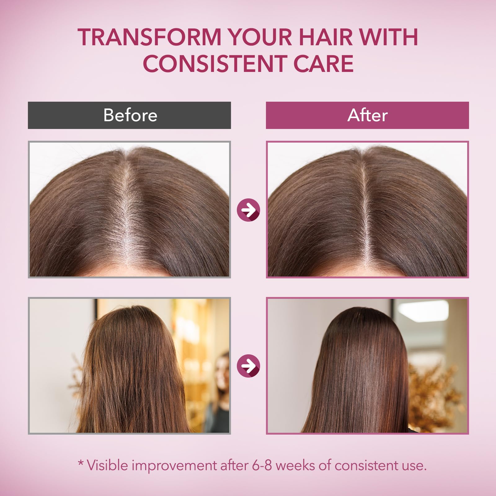 ProBliva Onion & Biotin Hair Growth Shampoo with Rosemary