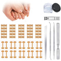Professional Pedicure Tools Ingrown Toenail Kit – 4-Piece Set with Breathable Corrector Strips, Curved Patches, File & Lifters