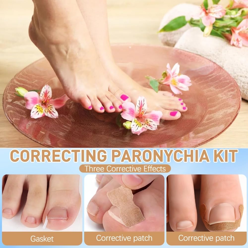 Professional Pedicure Tools Ingrown Toenail Kit – 4-Piece Set with Breathable Corrector Strips, Curved Patches, File & Lifters