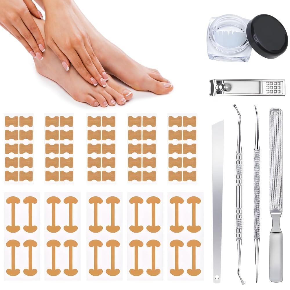 Professional Pedicure Tools Ingrown Toenail Kit – 4-Piece Set with Breathable Corrector Strips, Curved Patches, File & Lifters