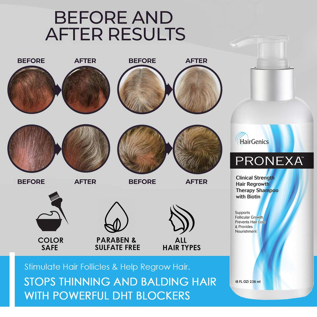 Pronexa Hairgenics Clinical Strength Hair Growth Shampoo with Biotin, Collagen & DHT Blockers – 8 fl oz