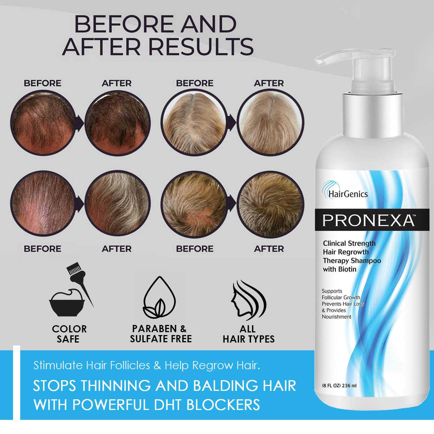 Pronexa Hairgenics Clinical Strength Hair Growth Shampoo with Biotin, Collagen & DHT Blockers – 8 fl oz