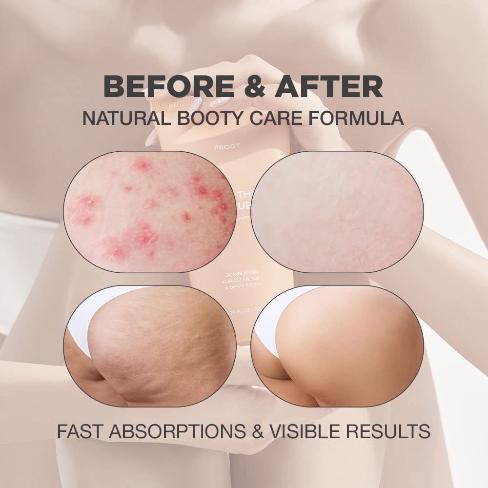 PROOT Butt Scrub Wash | Exfoliating Body Wash for Acne & Ingrown Hair