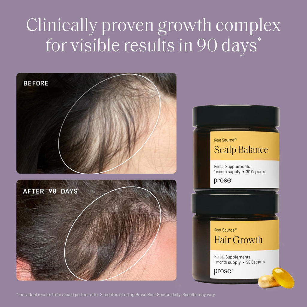 Prose Scalp Balance & Hair Growth Supplements – Clinically Studied Growth Complex, Vegan & Gluten Free