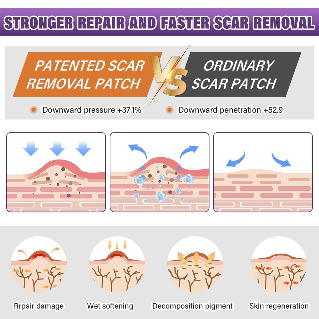 Psecici Silicone Scar Sheets Roll – Medical-Grade, Reusable Scar Tape for Surgical, C-Section, Tummy Tuck & Keloids (1.6" x 157" Roll)