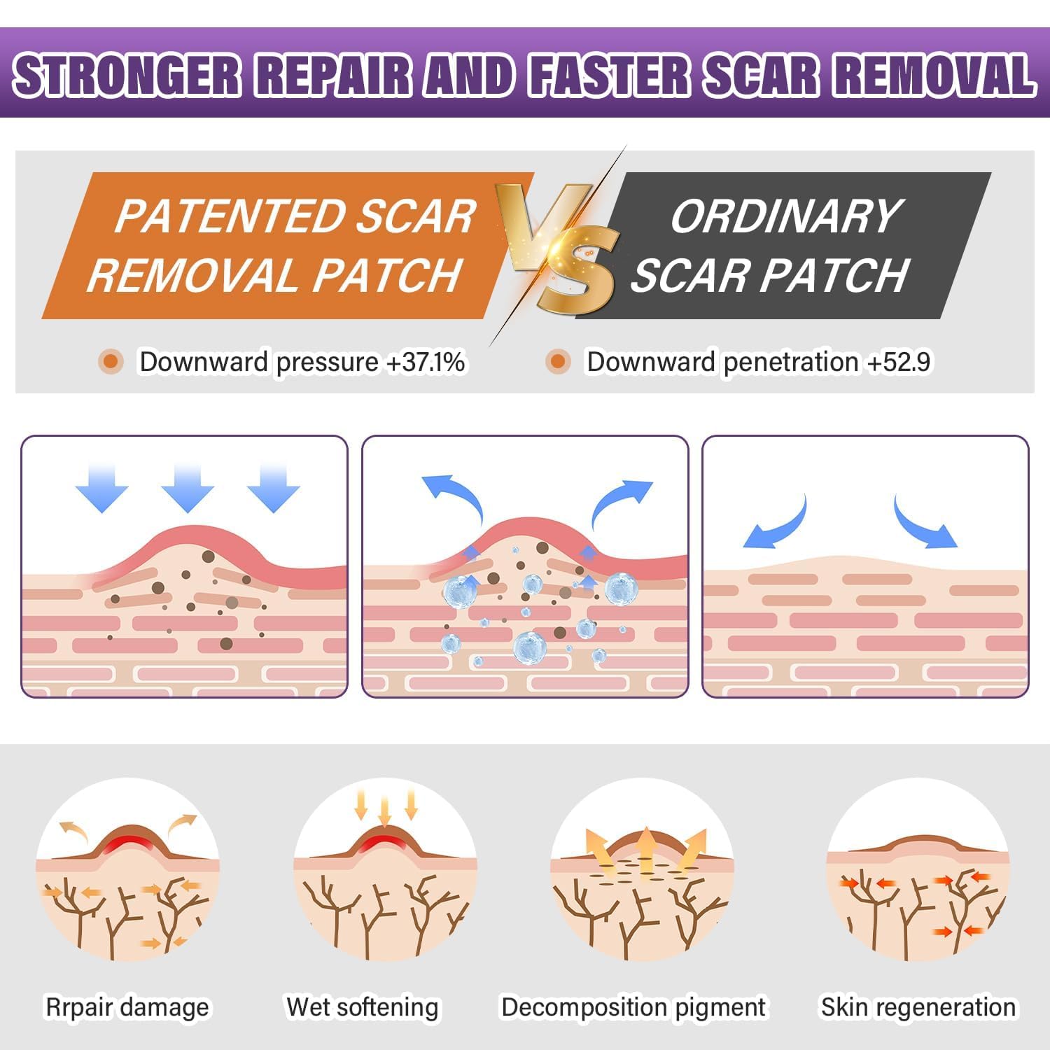 Psecici Silicone Scar Sheets Roll – Medical-Grade, Reusable Scar Tape for Surgical, C-Section, Tummy Tuck & Keloids (1.6" x 157" Roll)