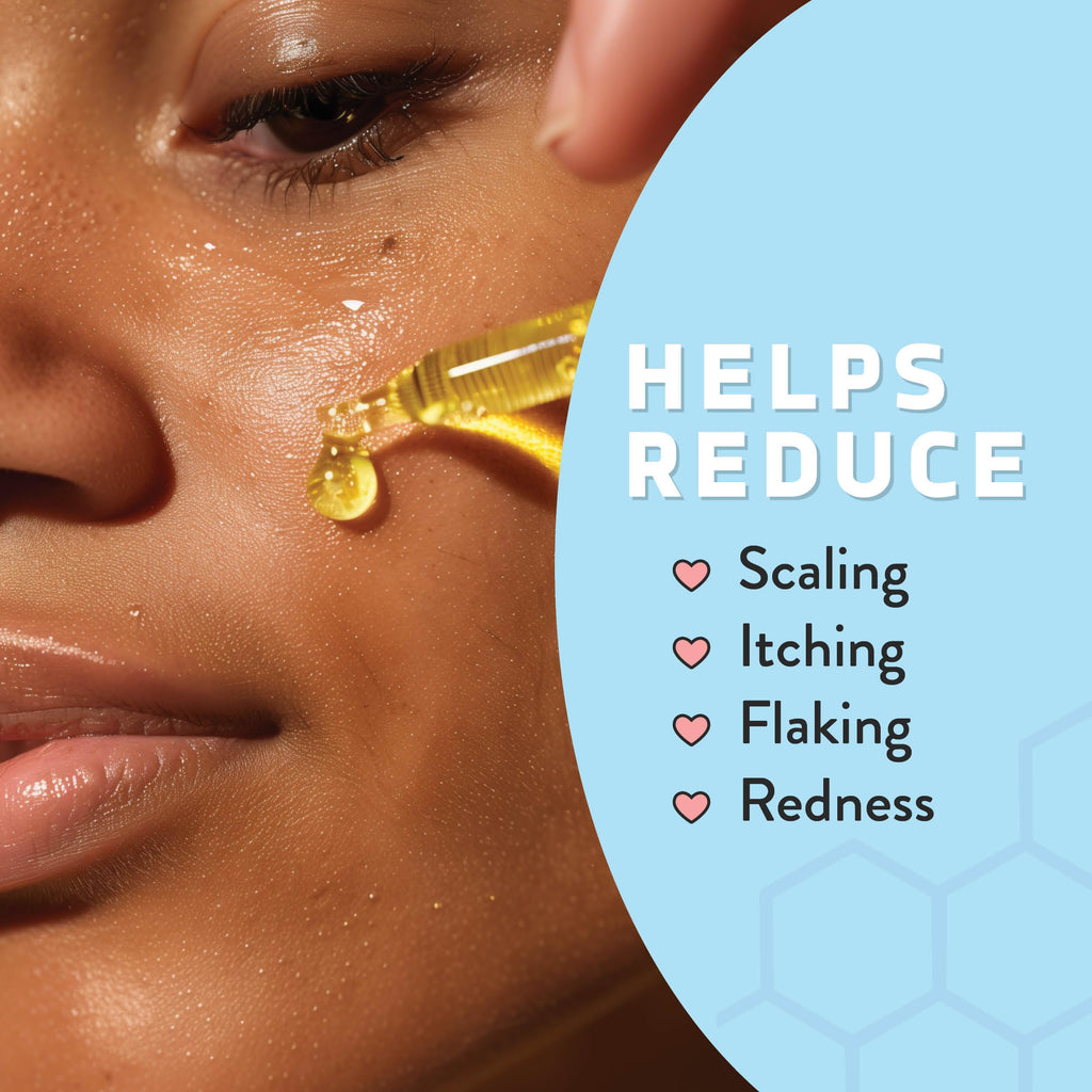Psoriasis Honey Nourishing Scalp & Skin Serum – Non-Comedogenic Dry Oil for Daily Hydration