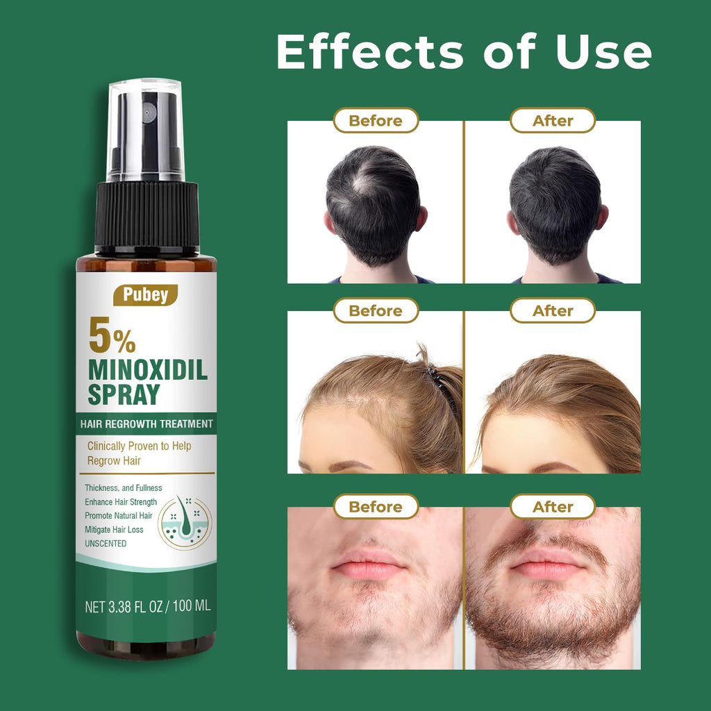 Pugbey 5% Minoxidil Spray for Hair Growth – Men & Women, Beard & Scalp, 3.38 oz (2 Month Supply)