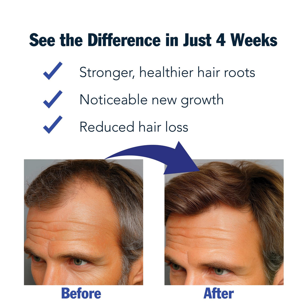 Puggaree Rosemary Hair Growth Serum Roll-On 3-Pack – 3% Rosemary, 3% Redensyl, 2% Anagain