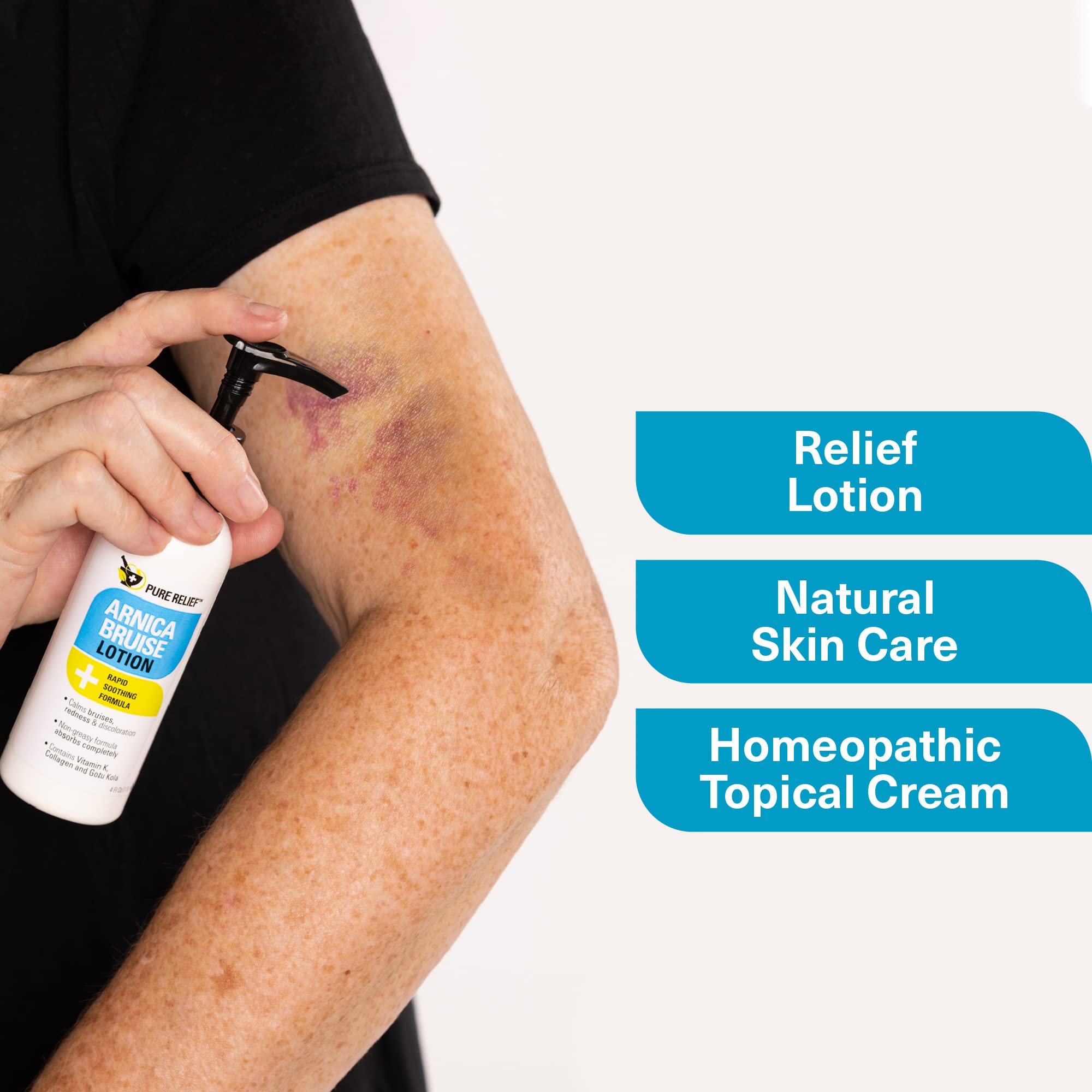 Pure Relief Arnica Cream: Extra Strength Bruise & Swelling Relief with Vitamin K, Collagen – 4 oz