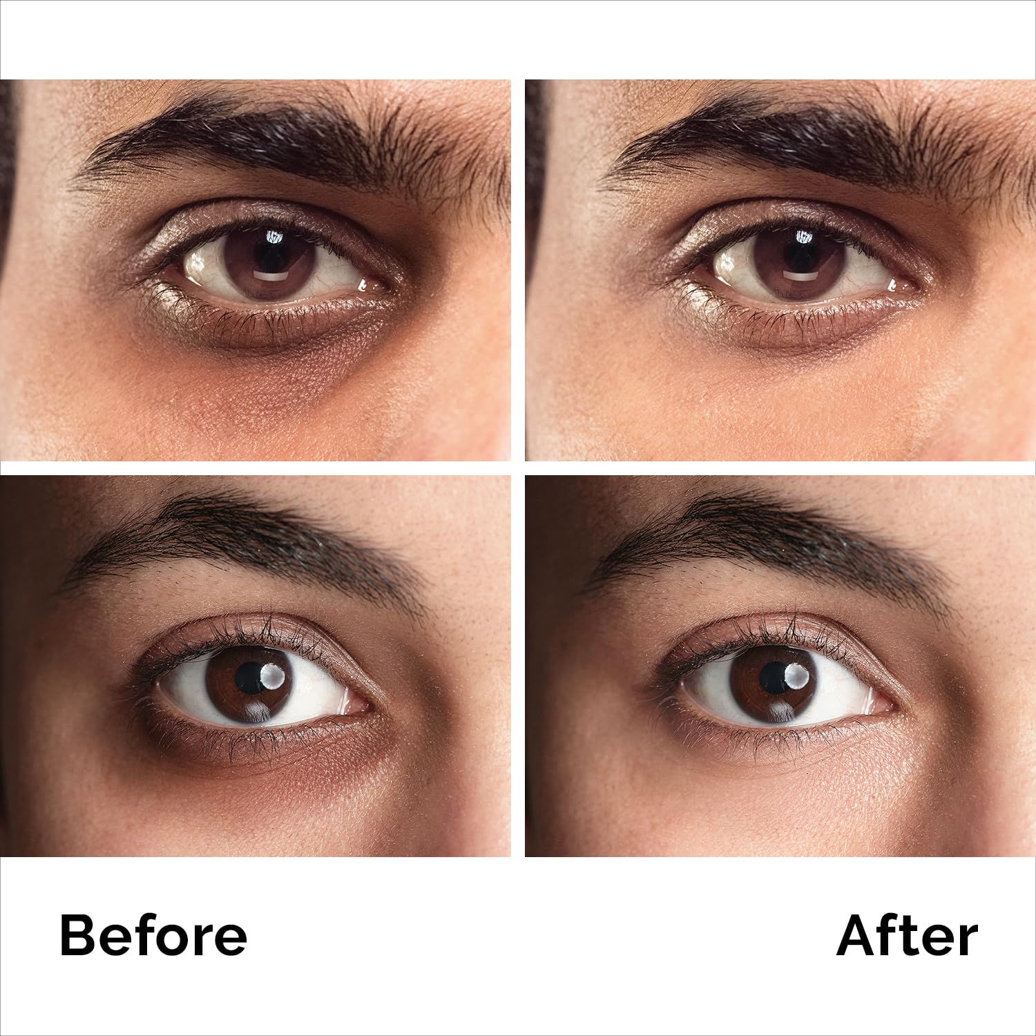 PURE RESEARCH Caffeine Eye Cream – Anti-Aging, Dark Circles & Puffiness (1.7 oz)